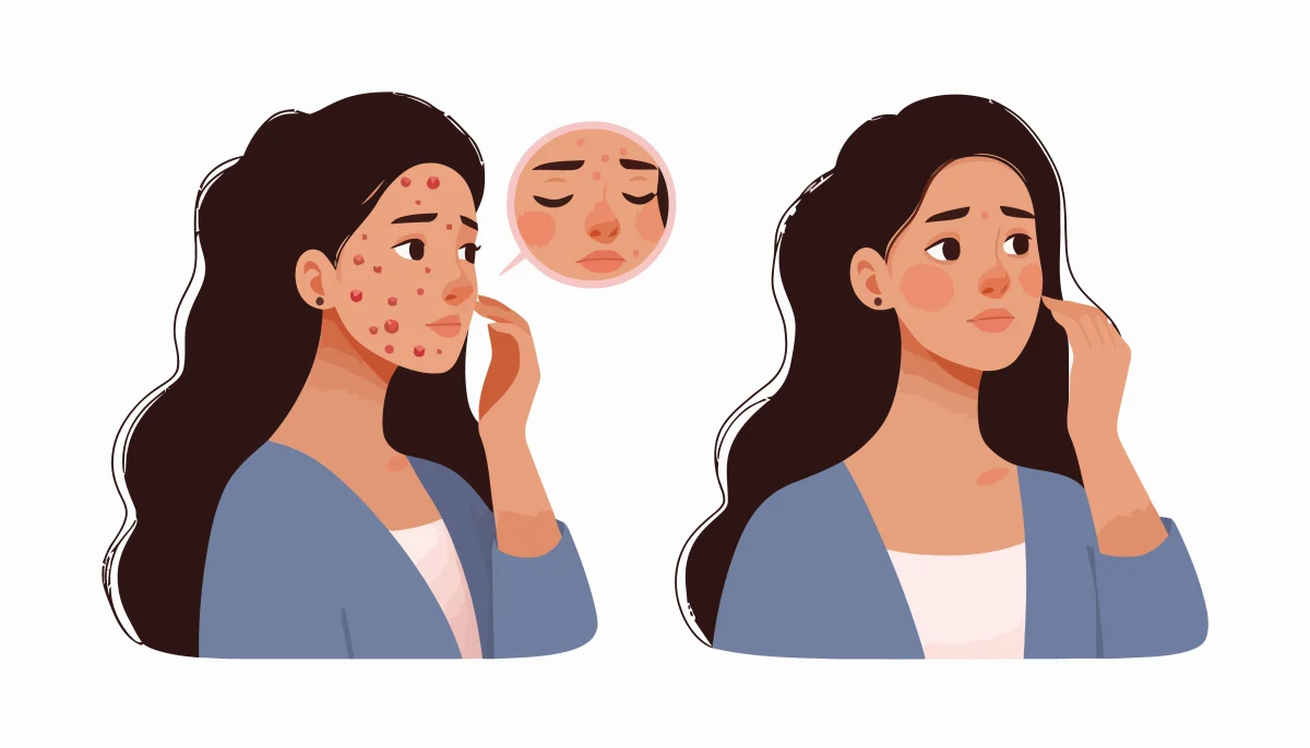 Huile de nigelle pour le visage - pourquoi l’adopter